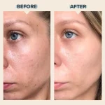 سرم ضدجوش و ضدلک آزلاییک اسید 10 درصد پائولاز چویس Paula’s Choice 10% Azelaic Acid Booster - Image 6